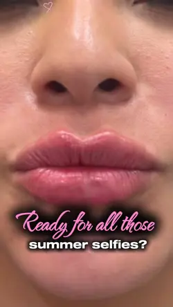 Lips 