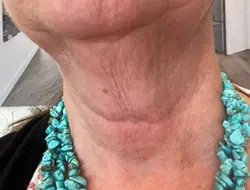 Dr Melaxin