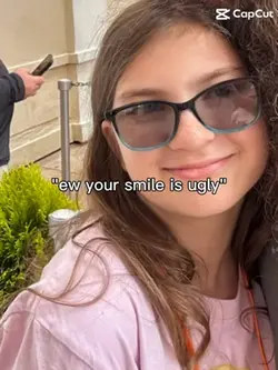 Ugly smile