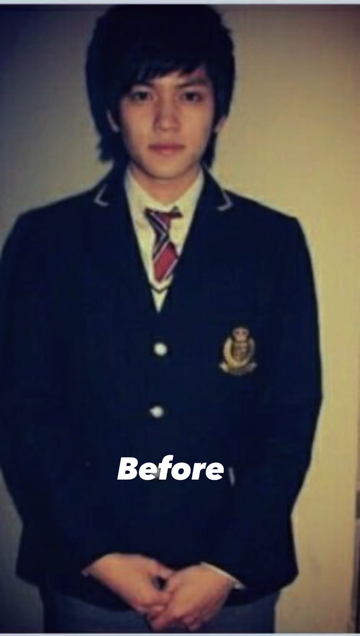 before after