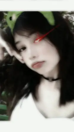 Eye Laser