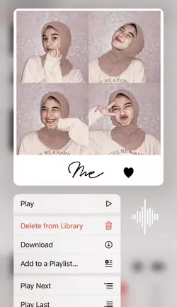 Prame Estetik Kece