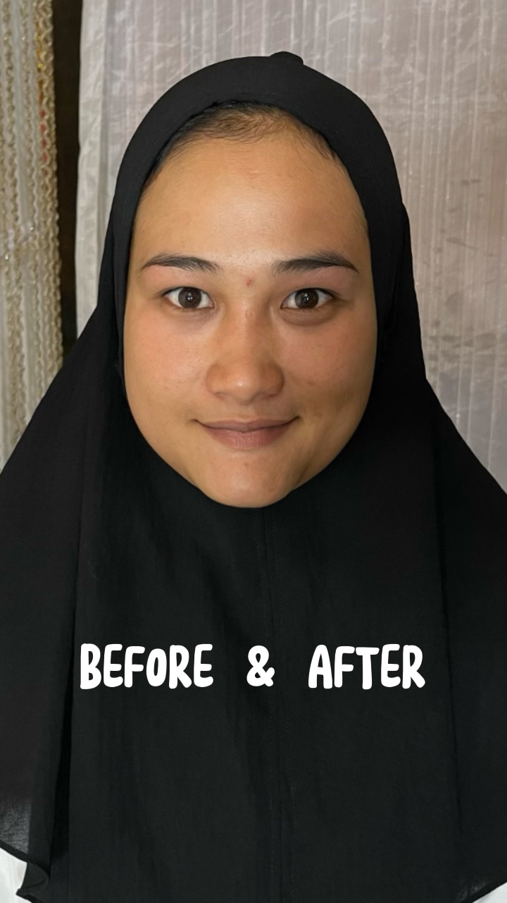 Before after 