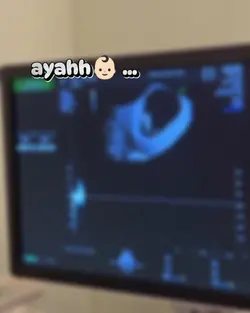 usg bayi | trend