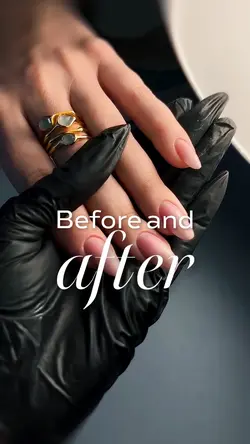Before and After