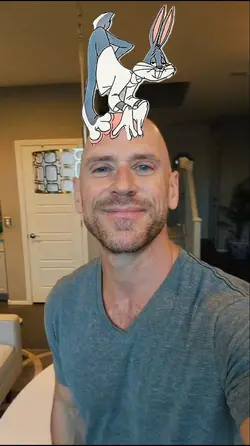 bald trend