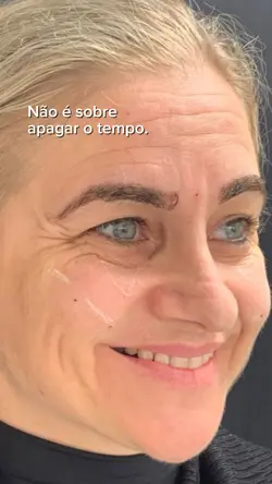 Trend antes e depois