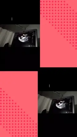 Pon tu foto 