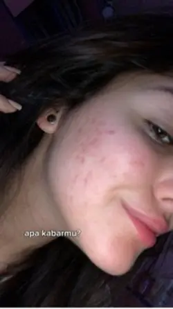 apa kabarmu?