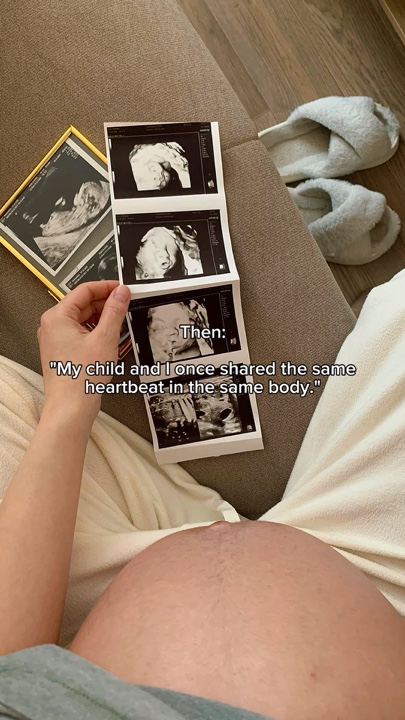 Then vs now