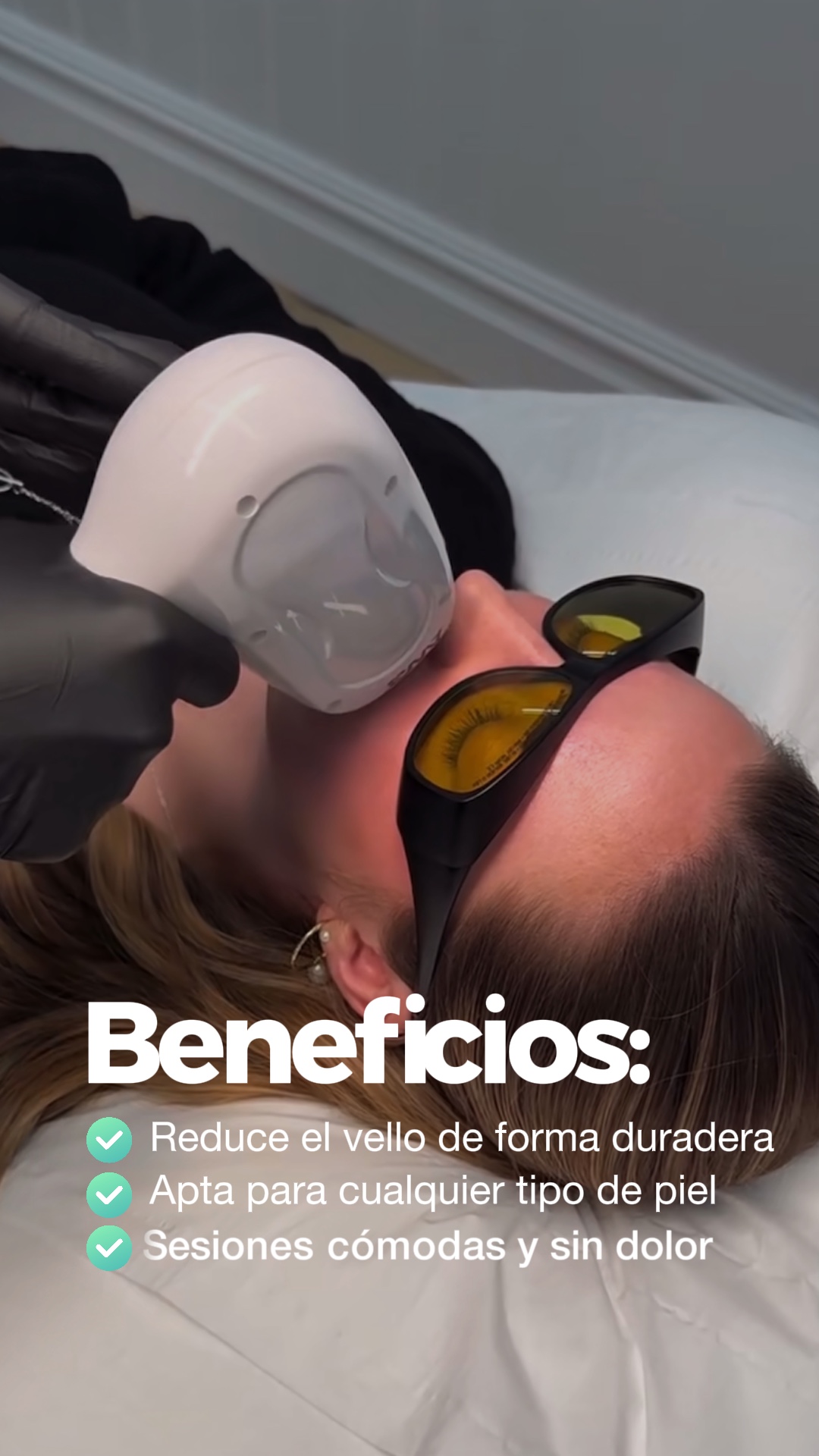 Depilacion laser 