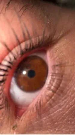 my eyesss