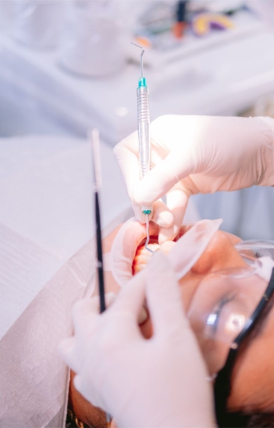 limpieza dental 