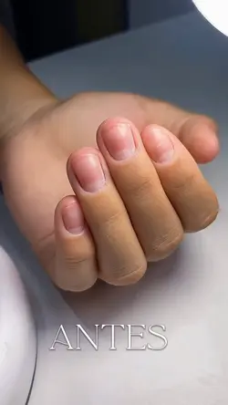 NAIL ANTES DEPOIS 