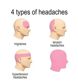 4 types of headaches