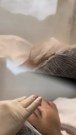 Limpeza de pele