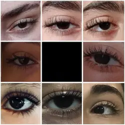 black eyes!