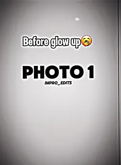 Before glow up🥱