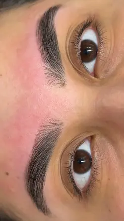 Antes e depois
