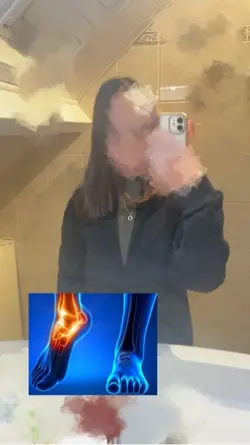 Mal cheville