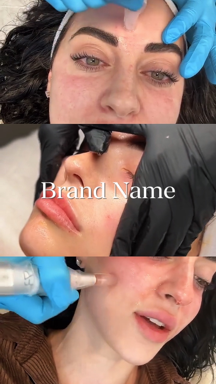Facial