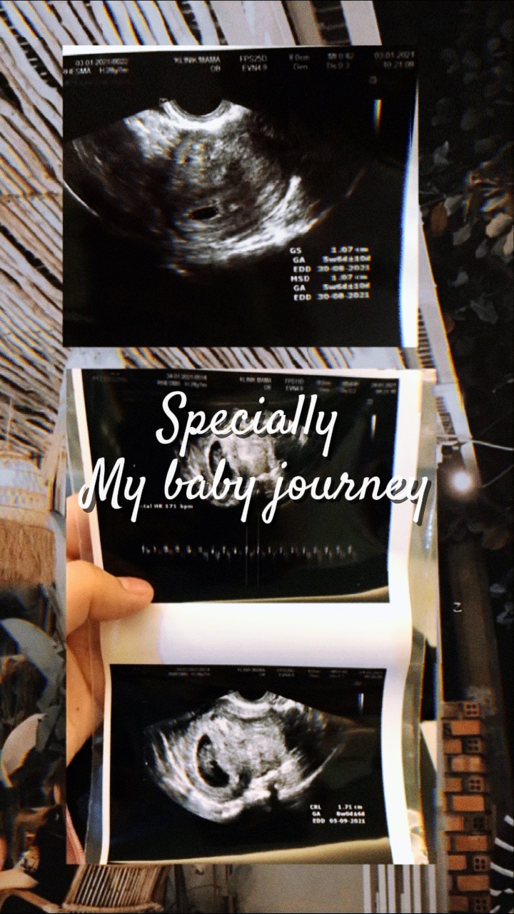 Baby journey 