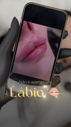 Preenchimento Labial