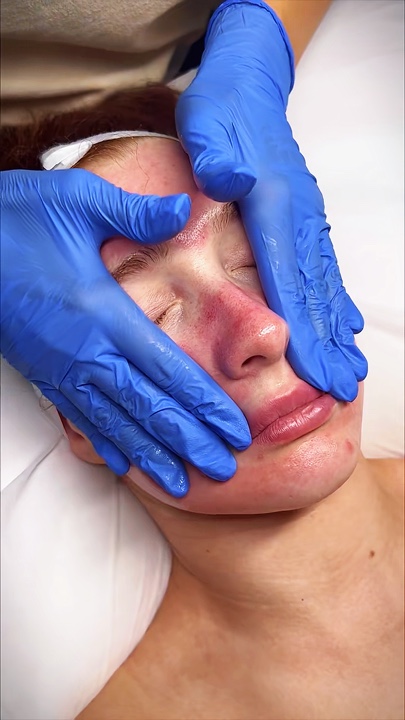 Facial