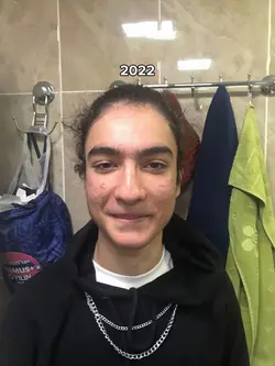 glow up