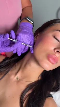 botox facial