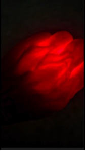Explosión