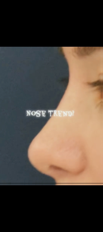 Nasentrend