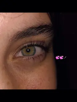 eye