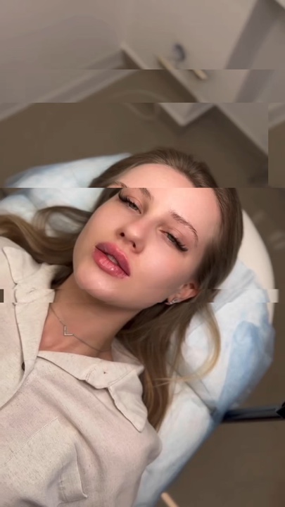 Relleno de labios