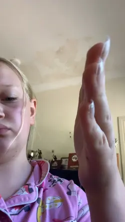 Nail transition 