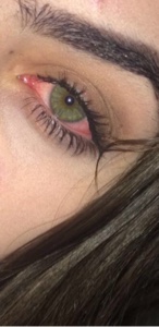 Ojos rojos 