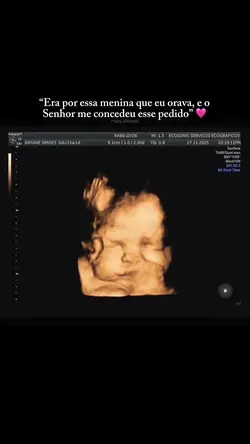 Gravidez