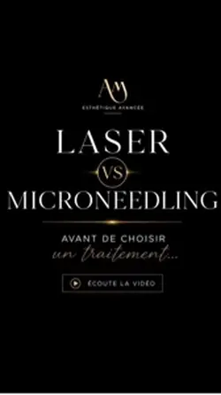 Laser vs Microneedli