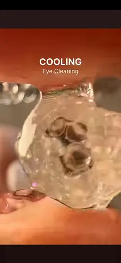 ASMR