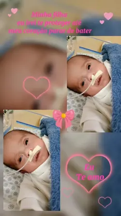 prematuridade