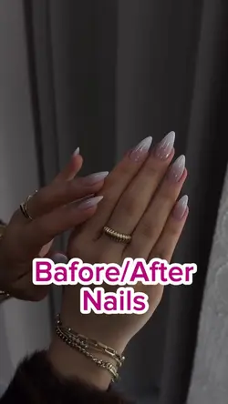Before and After💅