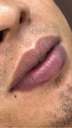 Lip Neutralization