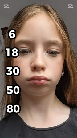 xd