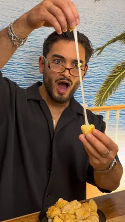 Snack 🍱 