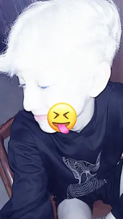 albino trend nih