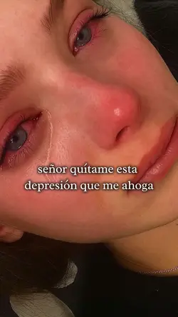 Depresión