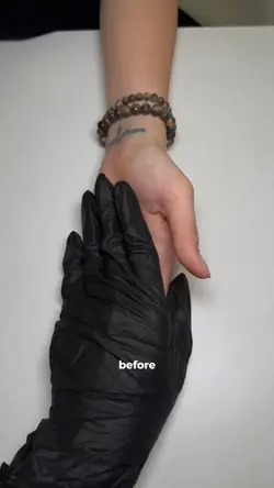 before after