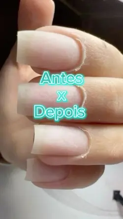 Antes x Depois Nails