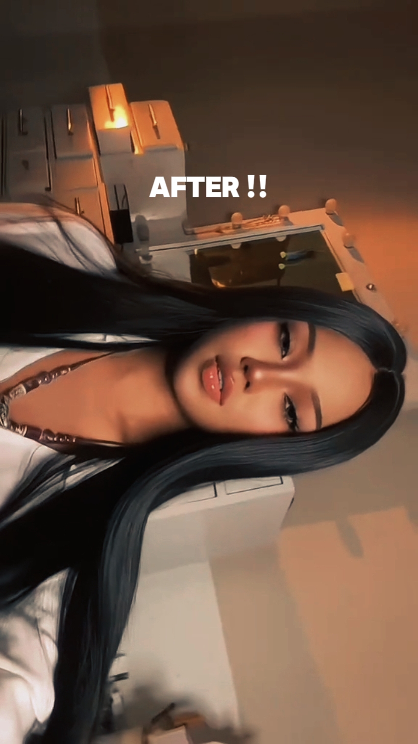 ANTES DESPUÉS 