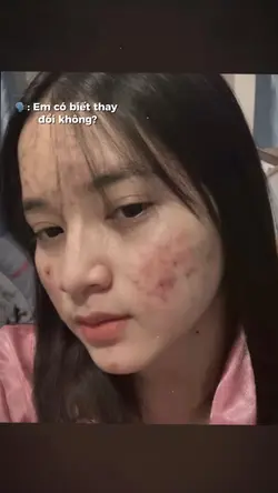 Em có biết thay đổi 